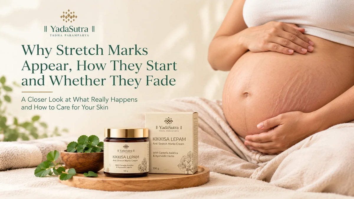 Why Stretch Marks Appear, How They Start and Whether They Fade