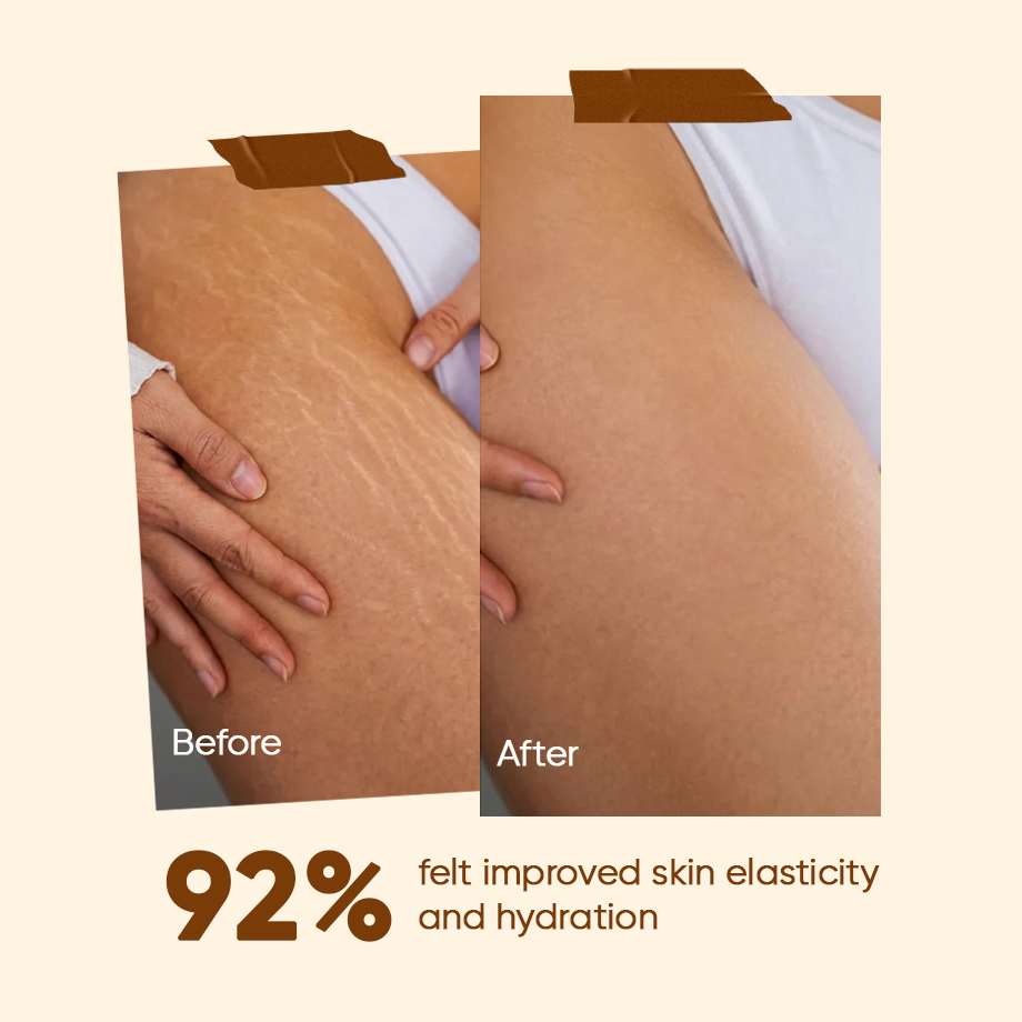 Kikkisa Lepam | Anti-Stretch Marks Cream (100g)